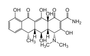 N70 - Salpingite e ooforite - HiDoctor CID-10